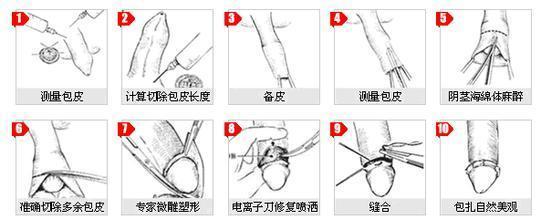 最新包皮環(huán)切手術治療詳解?